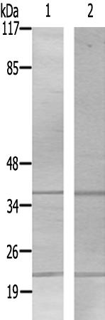 兔抗ZNF134多克隆抗体