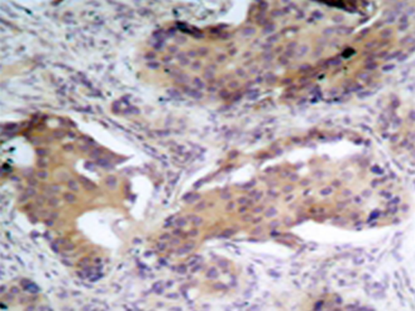 兔抗PTEN(Phospho-Ser370) 多克隆抗体