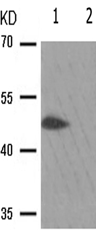 兔抗SMAD3(Phospho-Ser213) 多克隆抗体
