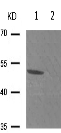 兔抗SMAD3(Phospho-Thr179) 多克隆抗体
