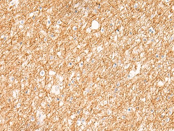 兔抗ZNF185多克隆抗体