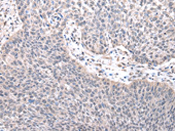 兔抗ZNF239多克隆抗体 