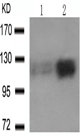 兔抗PTK2 (phospho-Tyr576 Tyr577)多克隆抗体