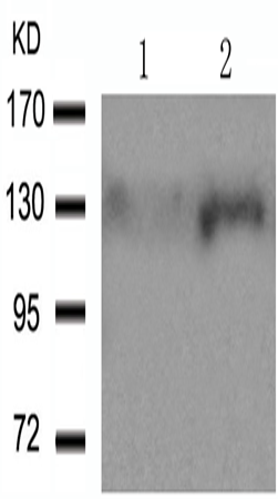 兔抗PTK2 (Phospho-Tyr861) 多克隆抗体