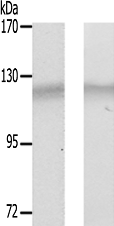 兔抗PTK2(Ab-843) 多克隆抗体