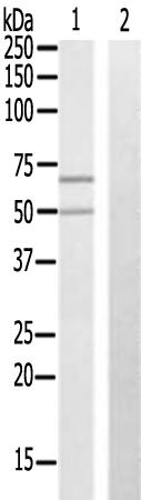 兔抗ZNF329多克隆抗体  