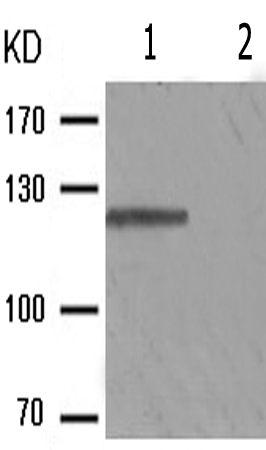 兔抗PTK2(Phospho-Tyr576) 多克隆抗体