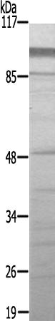 兔抗ZNF337多克隆抗体  