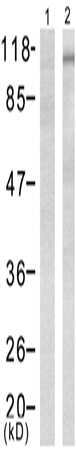 兔抗PTK2B (Phospho-Tyr402)多克隆抗体