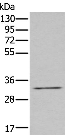 兔抗ZNF346多克隆抗体   