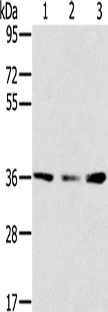 兔抗SMN1多克隆抗体