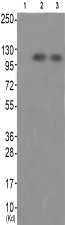 兔抗PTK2B(Phospho-Tyr579) 多克隆抗体