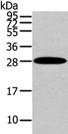 兔抗ZNF365多克隆抗体 