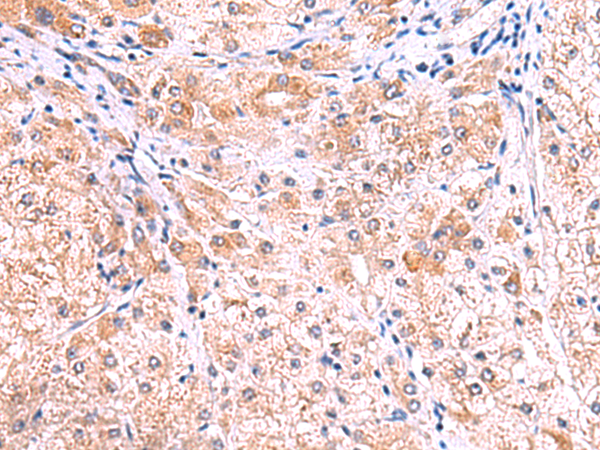 兔抗SMPD2多克隆抗体