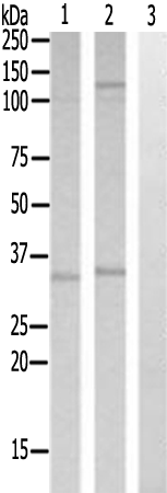 兔抗SMUG1多克隆抗体