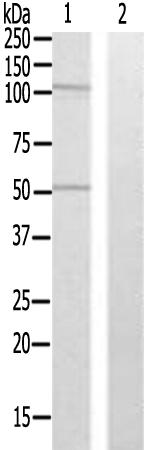 兔抗ZNF446多克隆抗体 
