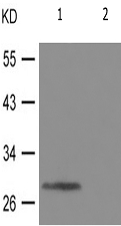 兔抗SNAI1(Phospho-Ser246) 多克隆抗体