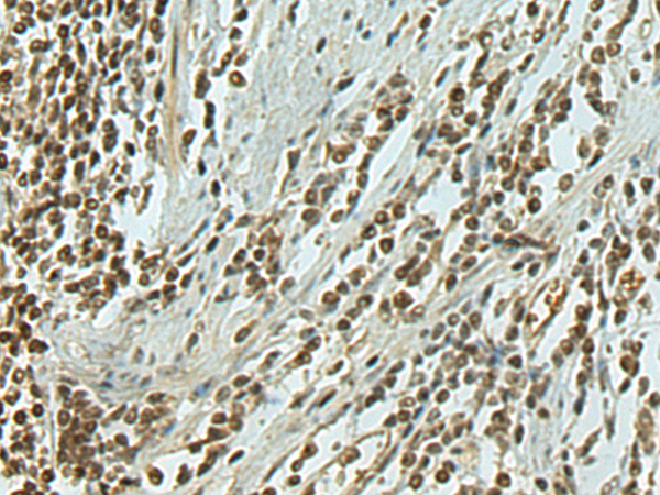 兔抗SNAI1多克隆抗体