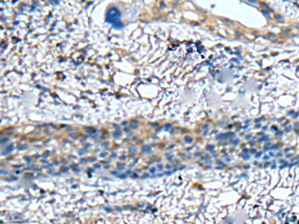 兔抗ZNF512多克隆抗体