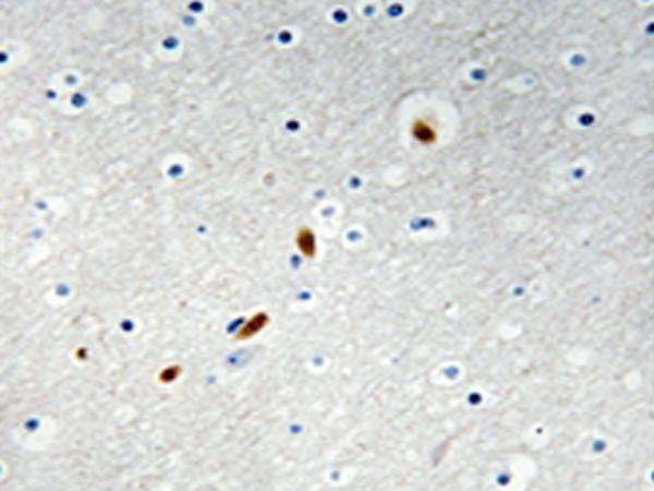 兔抗ZNF596多克隆抗体  