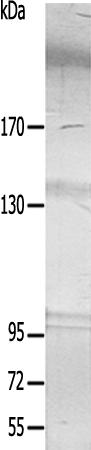 兔抗ZNF638多克隆抗体