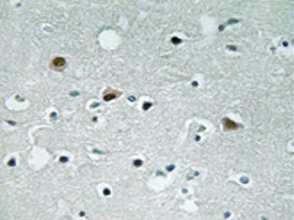 兔抗LATS1/2(Phospho-Thr1079/1041) 多克隆抗体