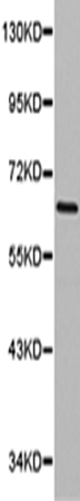 兔抗SNX9多克隆抗体