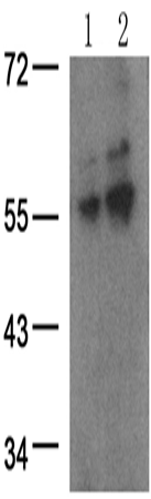 兔抗LCK (Phospho-Tyr394)多克隆抗体 