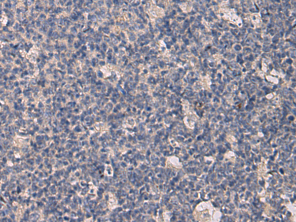 兔抗KRTAP1-1多克隆抗体