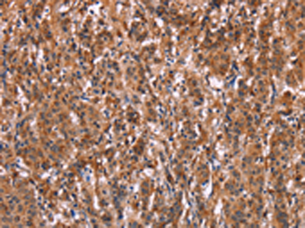 兔抗LILRB1多克隆抗体