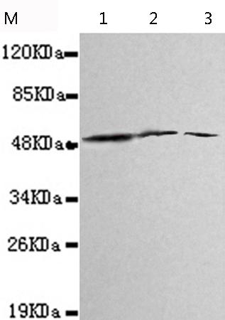 小鼠抗ALDH3A2单克隆抗体 