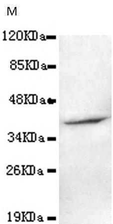 小鼠抗AMACR(C-term)单克隆抗体   