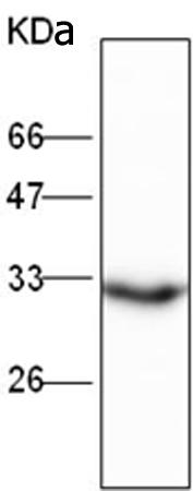 小鼠抗ANXA5单克隆抗体  