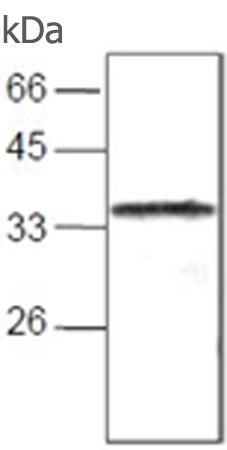 小鼠抗ANXA10单克隆抗体  