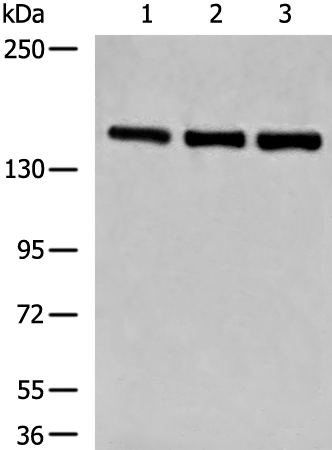 兔抗LPIN1多克隆抗体