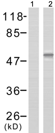 兔抗SRC(Phospho-Tyr418) 多克隆抗体