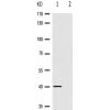 兔抗ADRB2(Phospho-Ser346)多克隆抗体 