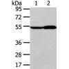 兔抗ALDH3A2多克隆抗体