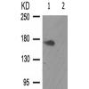 兔抗ALK(Phospho-Tyr1507)多克隆抗体