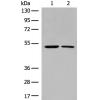 兔抗CHRNA9多克隆抗体   