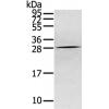 兔抗CLDN15多克隆抗体