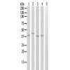 兔抗ARG2多克隆抗体