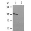 兔抗CSF1R(Phospho-Tyr809)多克隆抗体