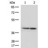 兔抗ATP6V1C1多克隆抗体