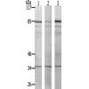 兔抗AURKC(Ab-202/175)多克隆抗体