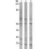 兔抗B4GALT3多克隆抗体