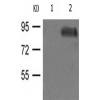 兔抗CTNNB1(phospho-Tyr333)多克隆抗体 