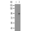 兔抗CTNNB1(Phospho-Tyr489)多克隆抗体 