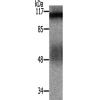 兔抗CTNND1(Ab-228)多克隆抗体 