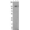 兔抗BCAR1(Phospho-Tyr410)多克隆抗体